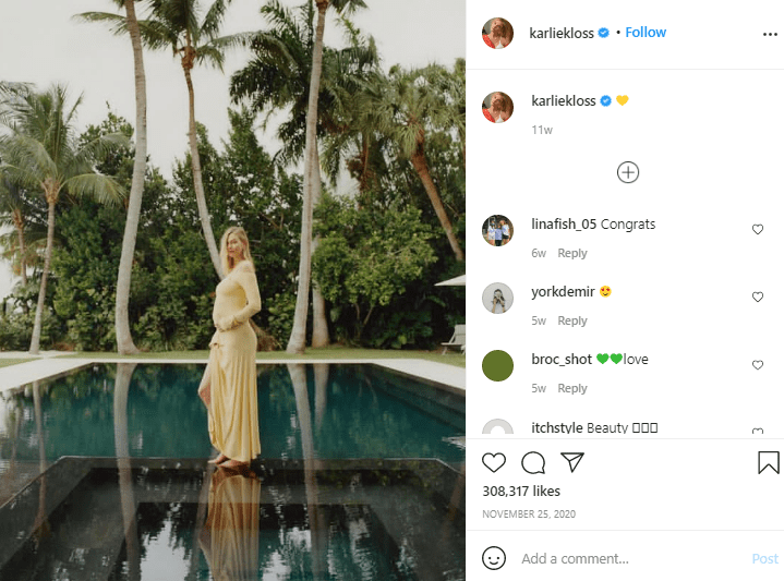 female instagram models (Karlie Kloss)